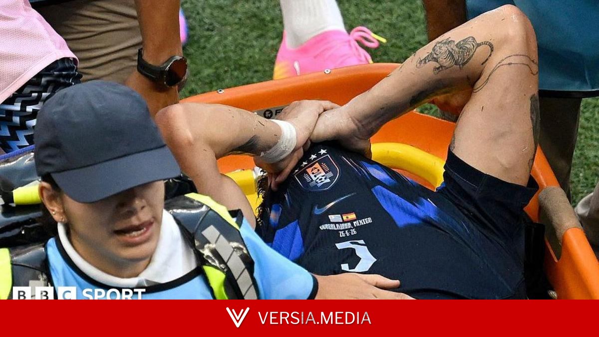 Ugarte has 'most serious injury footballer can face'