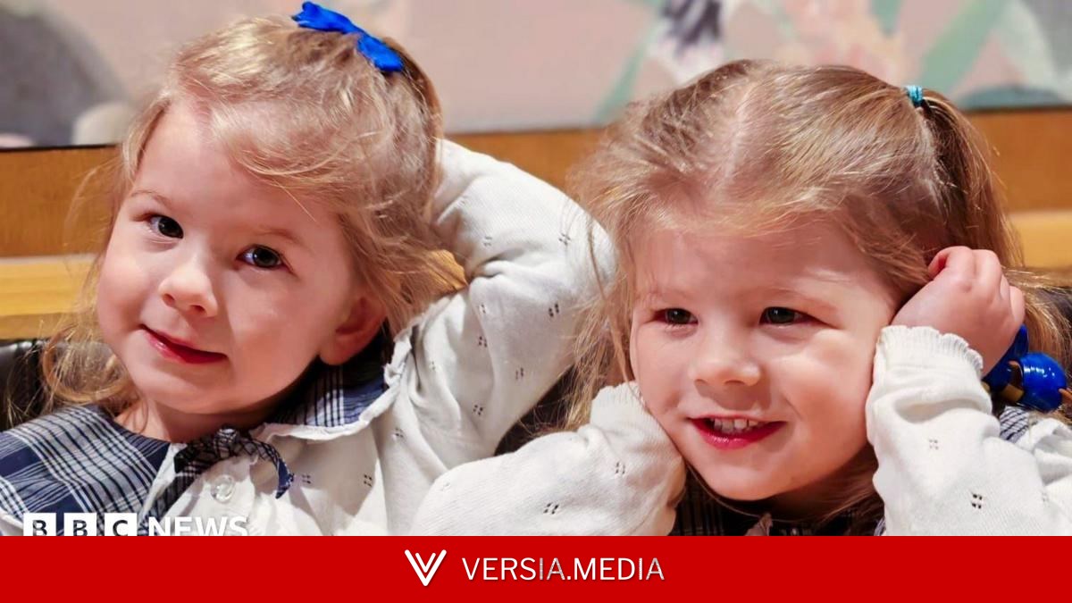 Pioneering treatment saves identical twins from rare pregnancy condition